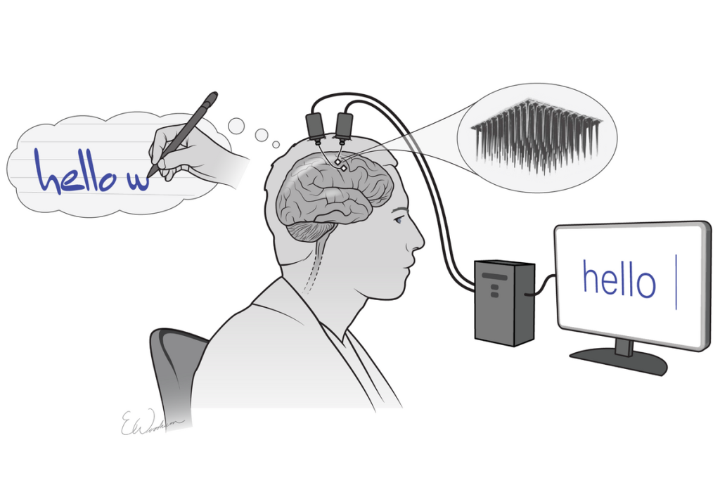 Brain-Computer Interface Bcis